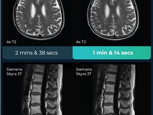 深透医疗完成新一轮数千万美金股权融资，加速国产创新，推进全球产品线落地